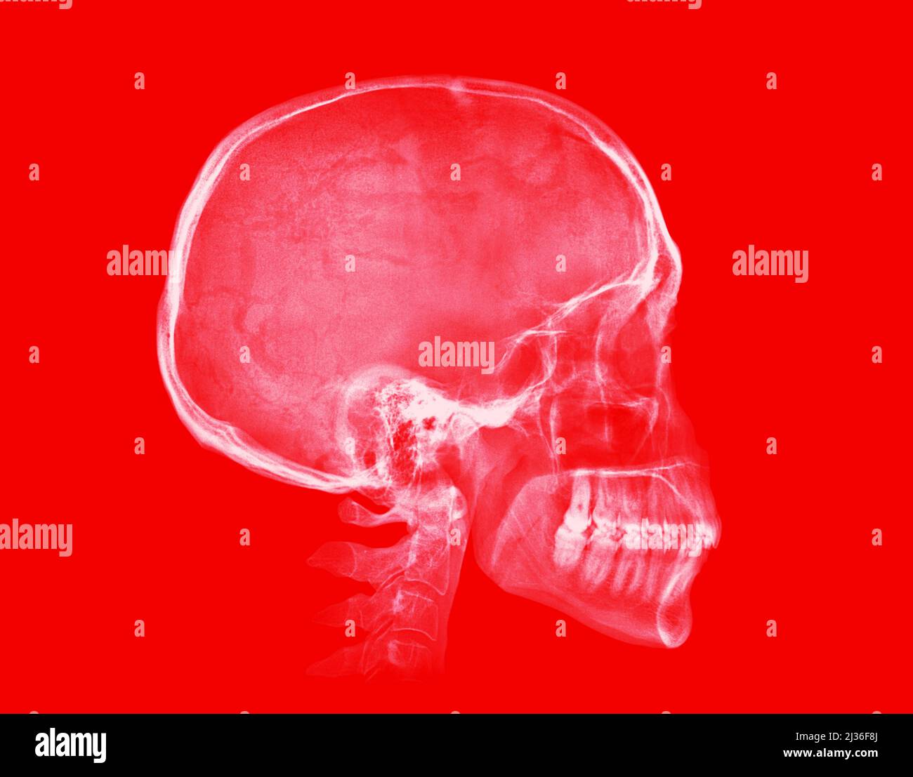Human skull. X-ray image isolated on red background Stock Photo