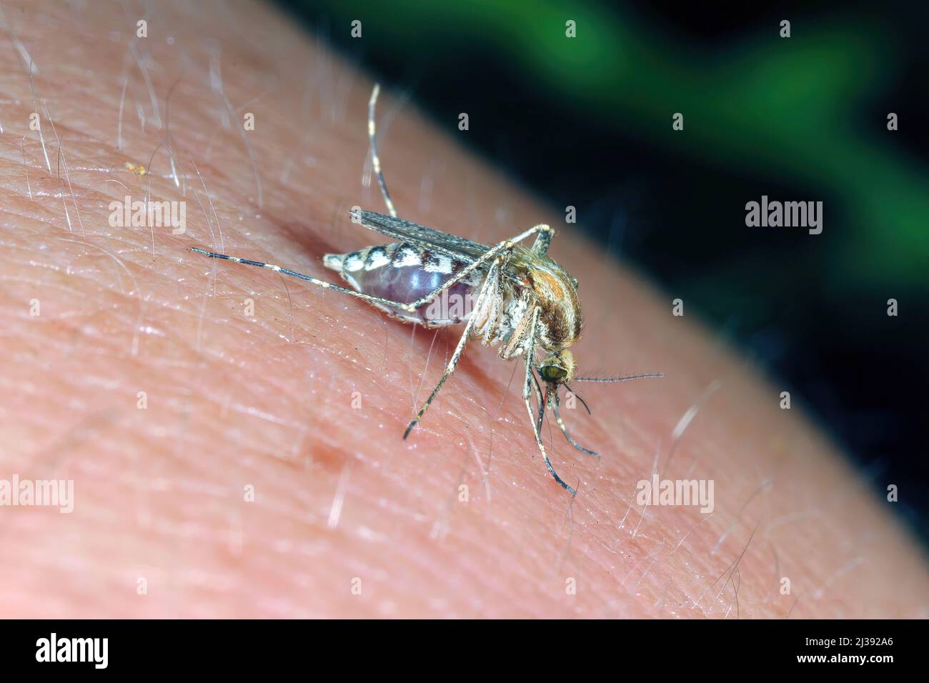 Dangerous Malaria Infected Mosquito Skin Bite. Leishmaniasis, Encephalitis, Yellow Fever, Dengue, Malaria Disease, Mayaro or Zika Virus Infectious. Stock Photo