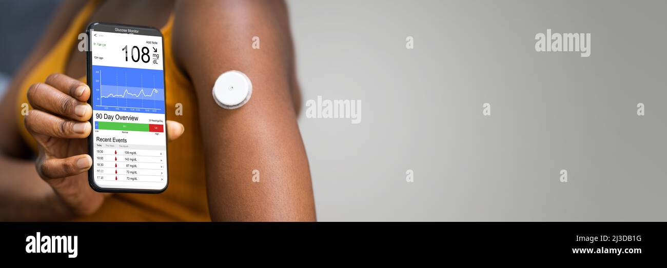 Continuous Glucose Monitor Blood Sugar Test Smart Phone App Stock Photo Continuous Glucose Monitor Blood Sugar Test Smart Phone App Stock Photo
