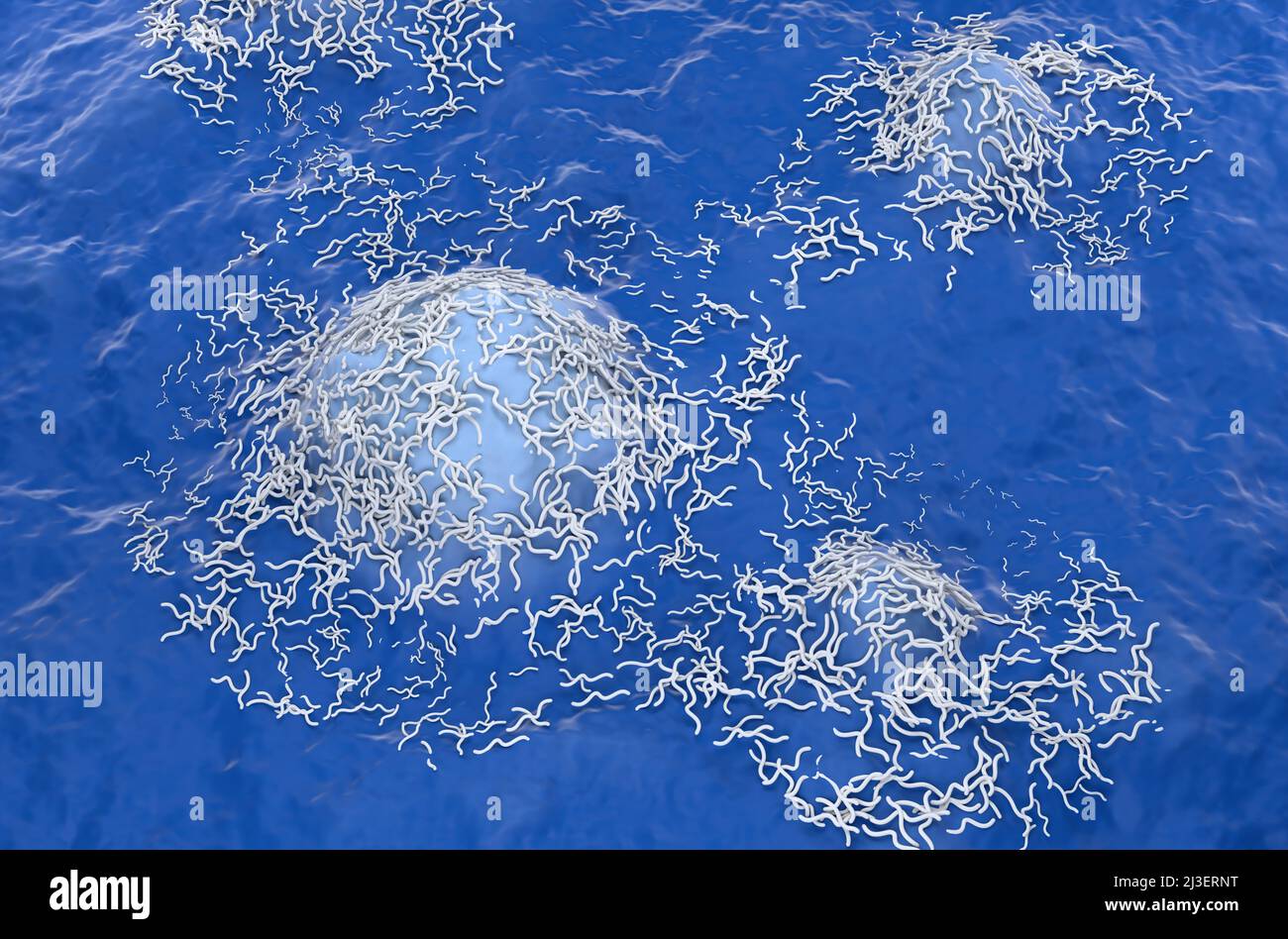Ependymoma cancer cells (brain tumor) - isometric view 3d illustration Stock Photo