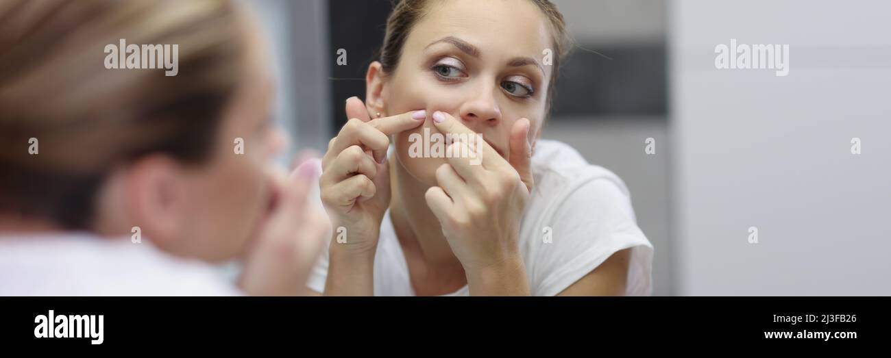 Prone skin hi-res stock photography and images - Alamy