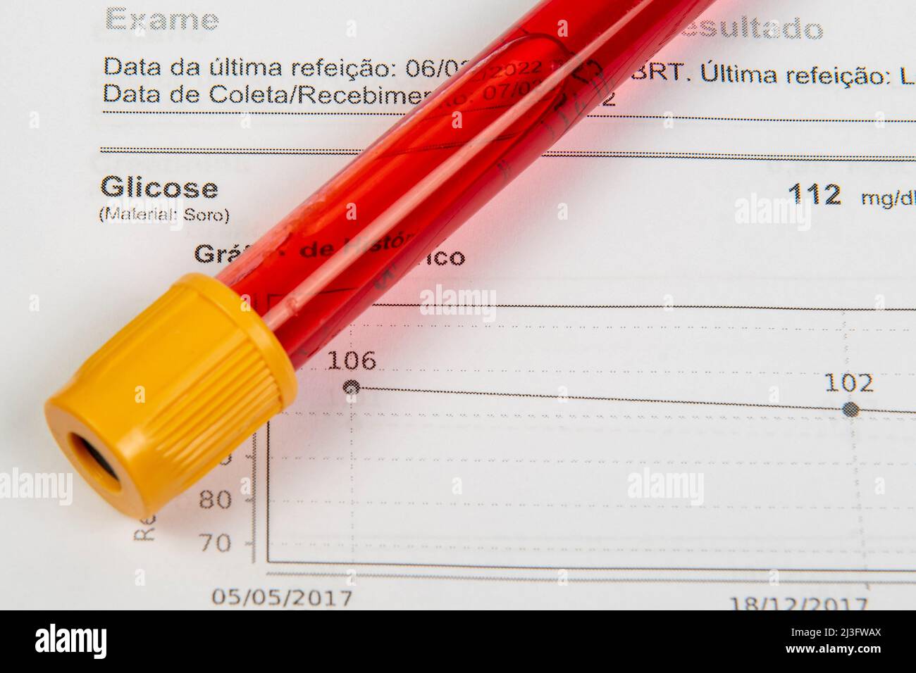 Blood collection and analysis, test tube with blood and exam result