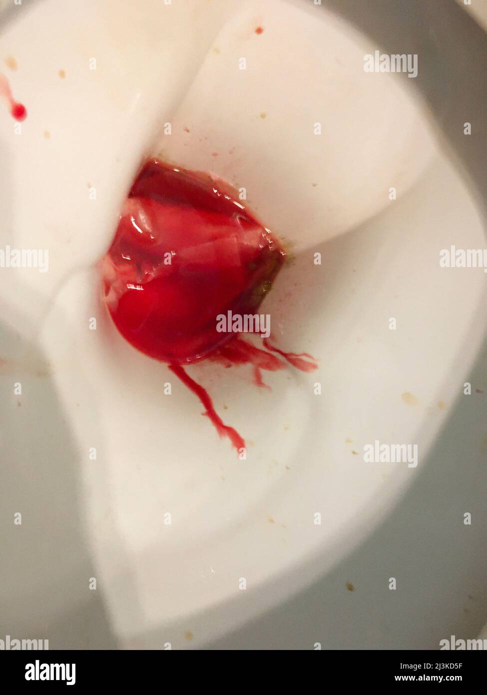 Frisches helles Blut und Schleim in der Toilette Stock Photo