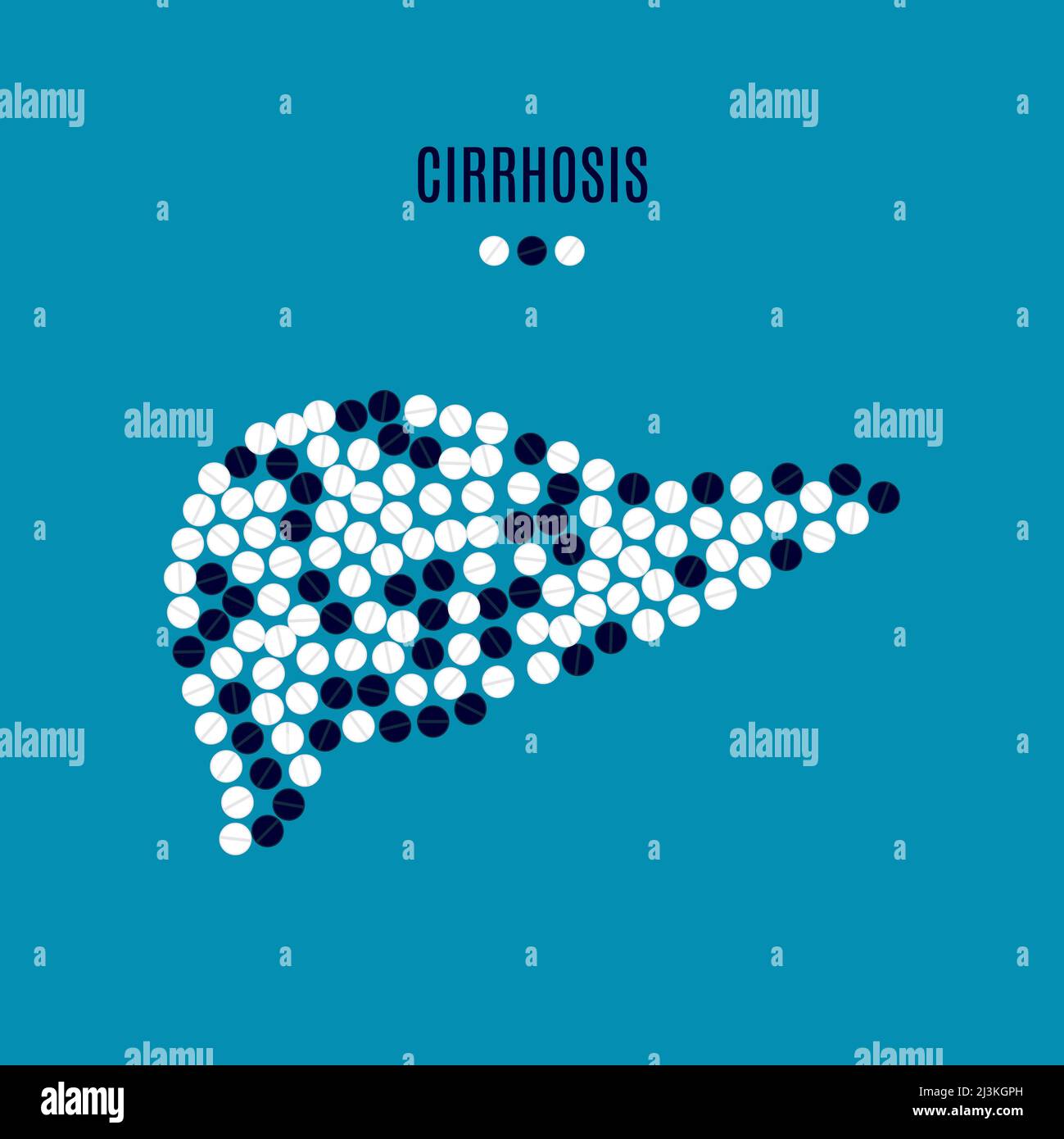 Cirrhosis of the liver hi-res stock photography and images - Alamy
