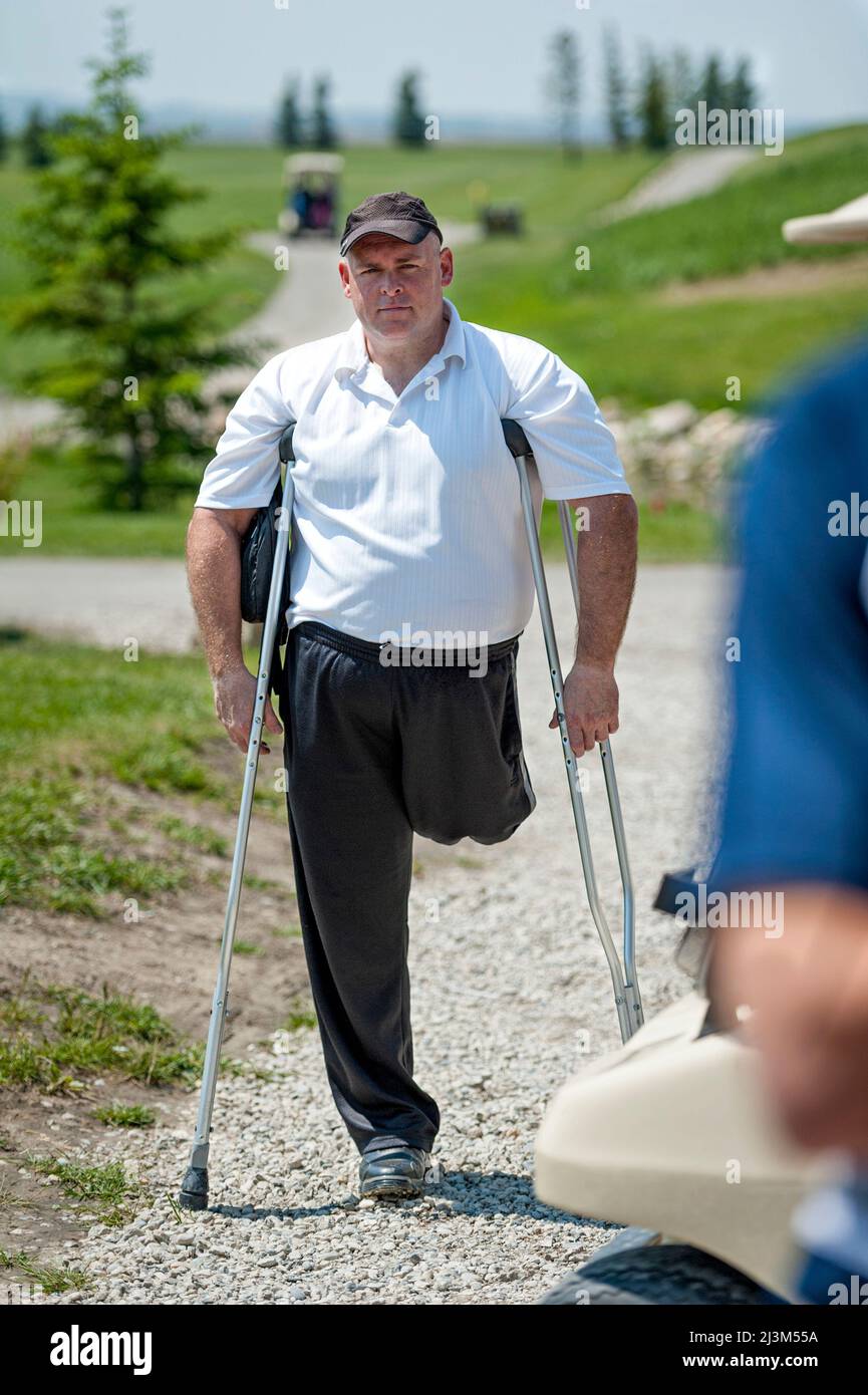 Man with amputated leg stands with crutches on a gravel path on a golf course, looking at the camera; Okotoks, Alberta, Canada Stock Photo