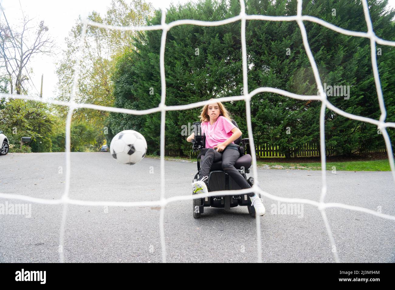 Eleven year old girl with Ullrich Congenital Muscular Dystrophy plays