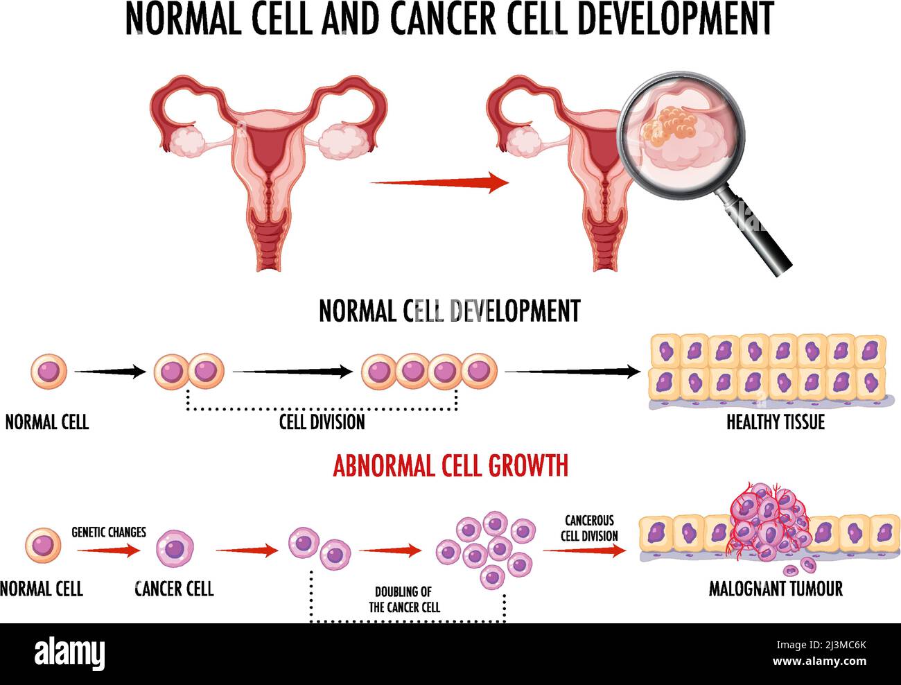 Diagram showing normal and cancer cell illustration Stock Vector Image ...
