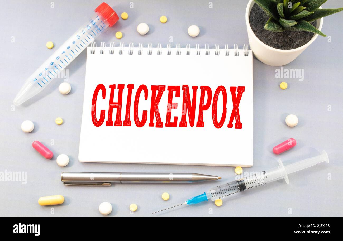 Chickenpox Lettering text chickenpox on white paper Stock Photo - Alamy