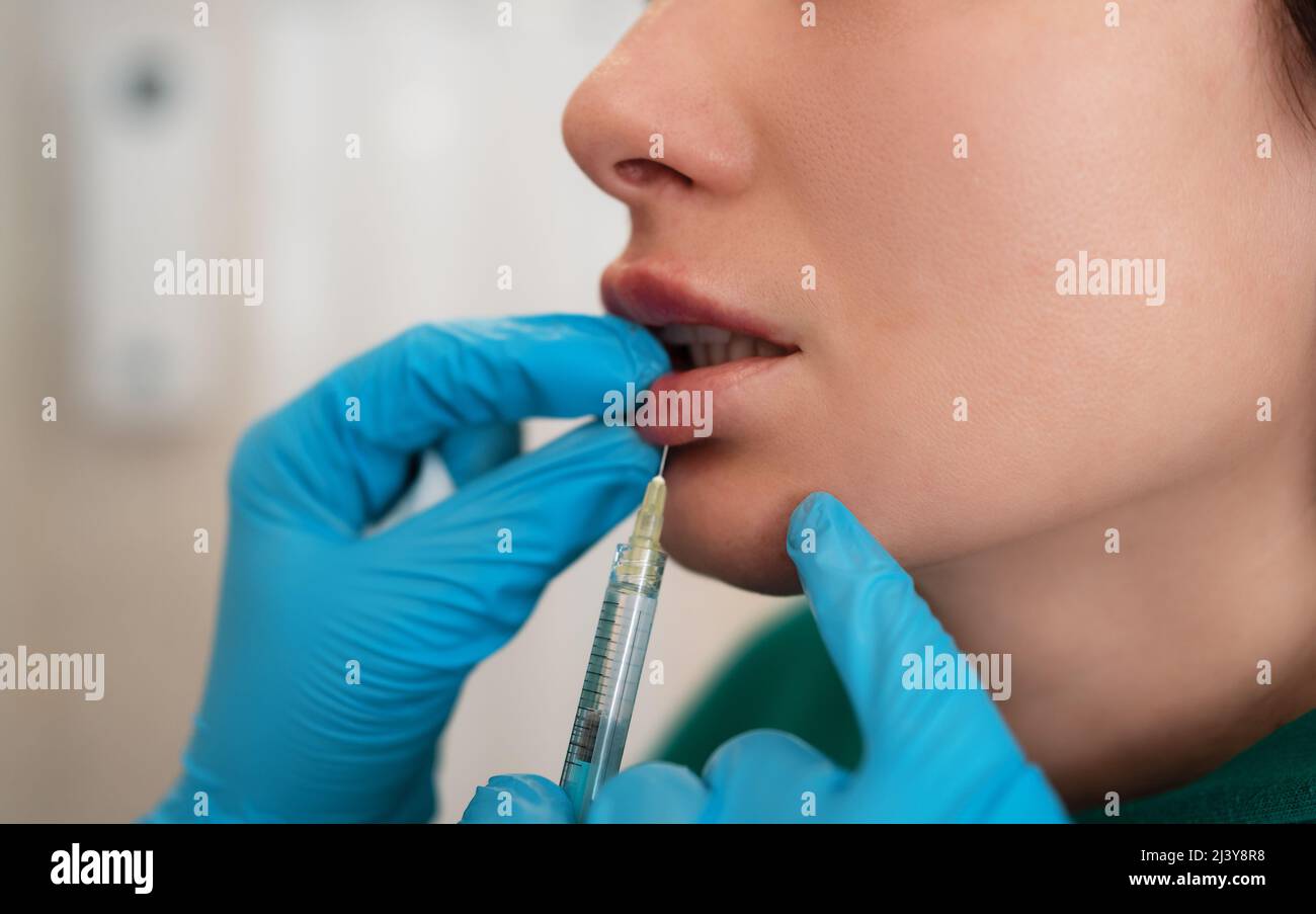 Young woman gets hyaluronic filler or botox cosmetic injection in lips, close up. Rejuvenating facial treatment. Stock Photo