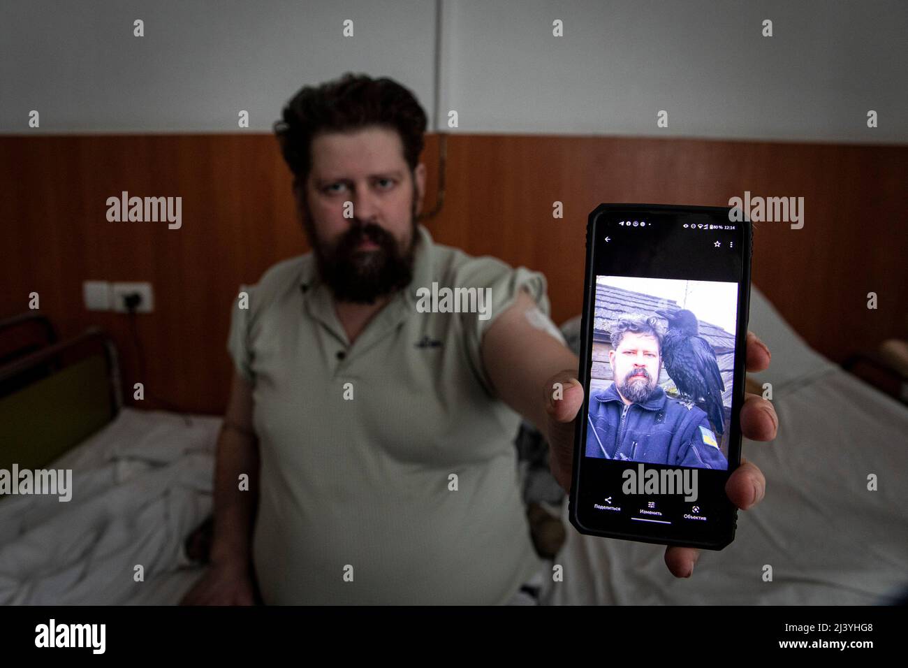 Andrey Bychenko (32), from Gosteml, Kyiv Oblast, injured with multiple bone fractures and severe blood loss caused by a Russian land mine on February 25 displays a smartphone screen with a photo of his friend who was killed by the Russian shelling. As the war continue to rage, numerous Ukrainian civilians were injured and killed under crossfire and the Russian offensive, and hospitals in Kyiv are now stocked with survivors under medical treatment. According to the United Nations, until March 23, over 977 civilians were killed and 1,594 injured. Stock Photo