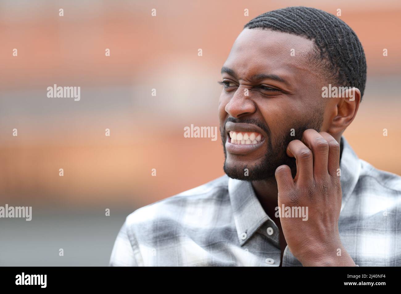 Man with black skin scratching itchy beard in the street Stock Photo