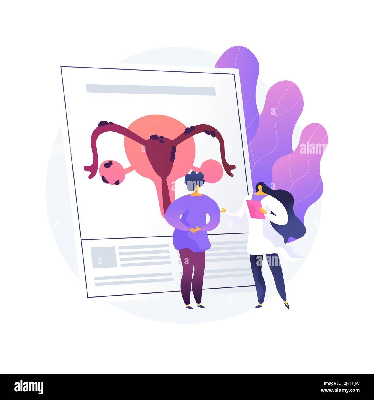 Endometriosis abstract concept vector illustration. Endometrium ...