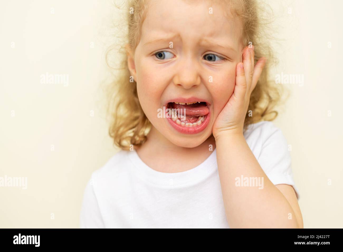 The child has a toothache. Children's caries. Stock Photo