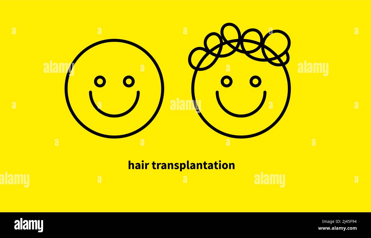Hair transplantation, doodle icon. Head with bald head and with in hair, comparison before and after hair transplantation Stock Vector