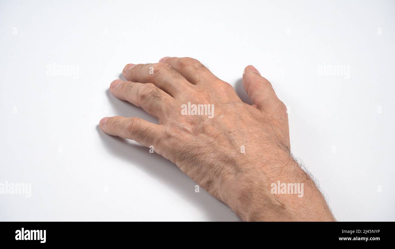 Mutations in adult axonal sensorimotor polyneuropathy Stock Photo Alamy