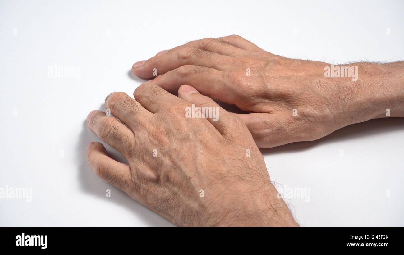 Mutations in adult axonal sensorimotor polyneuropathy Stock Photo Alamy