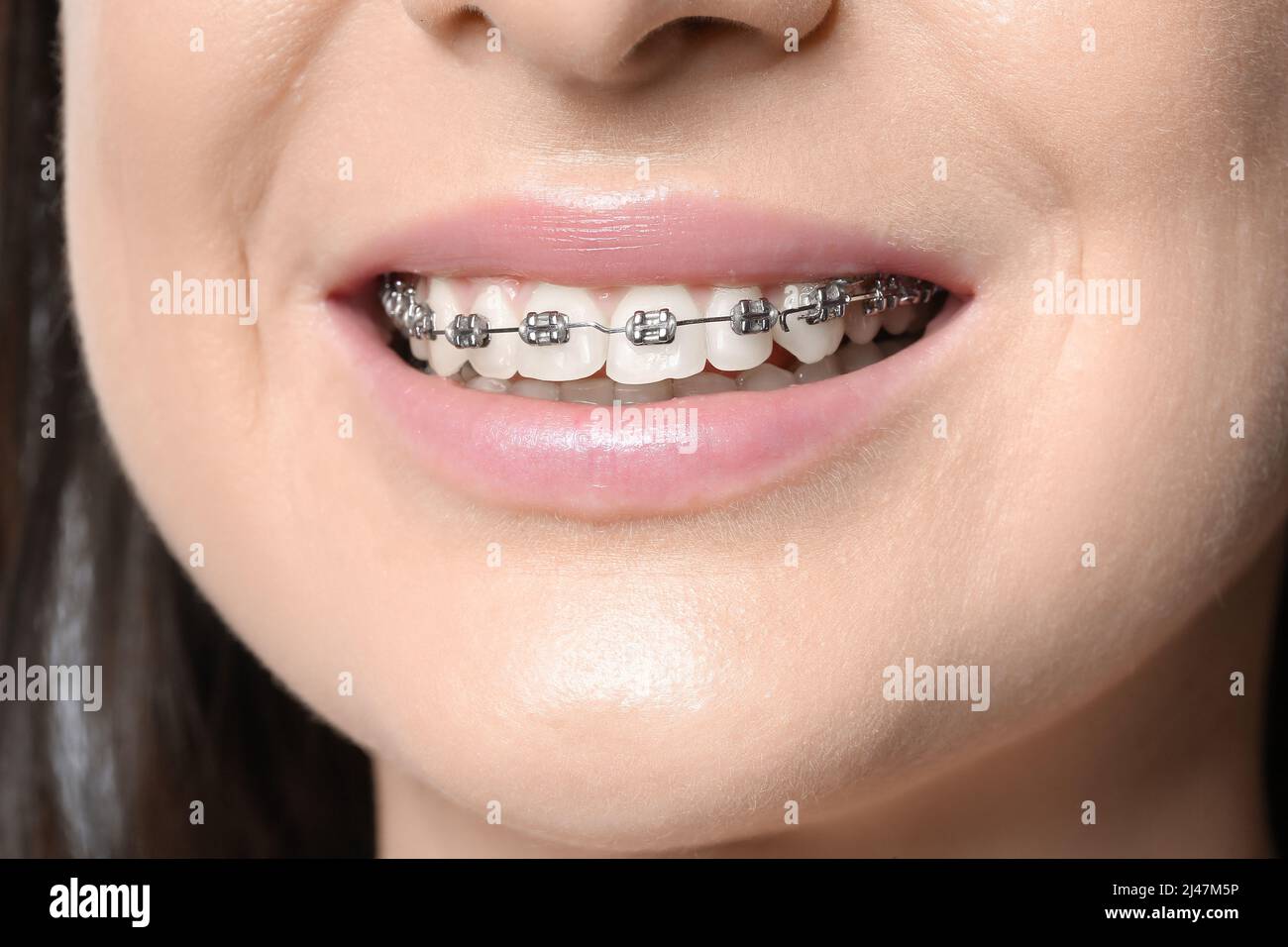 Overbite smile smiling hi-res stock photography and images - Alamy