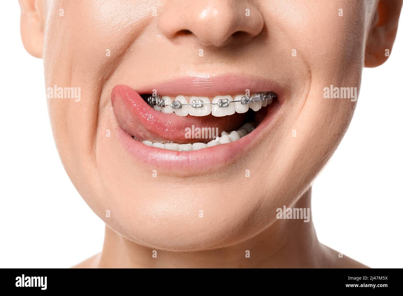 Girl braces tongue hires stock photography and images Alamy