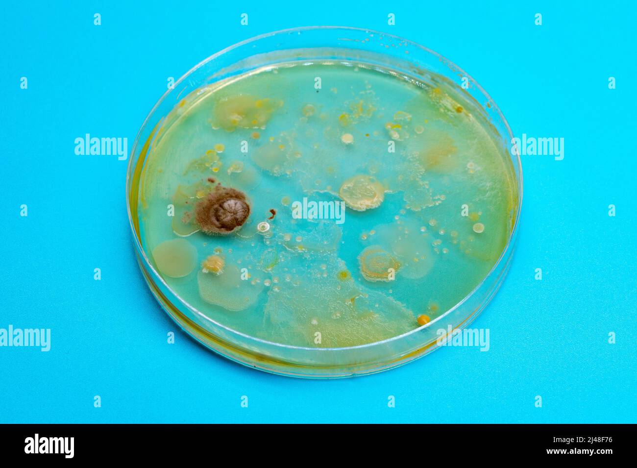 Petri dish with biological samples in a laboratory of a medical clinic Stock Photo Alamy