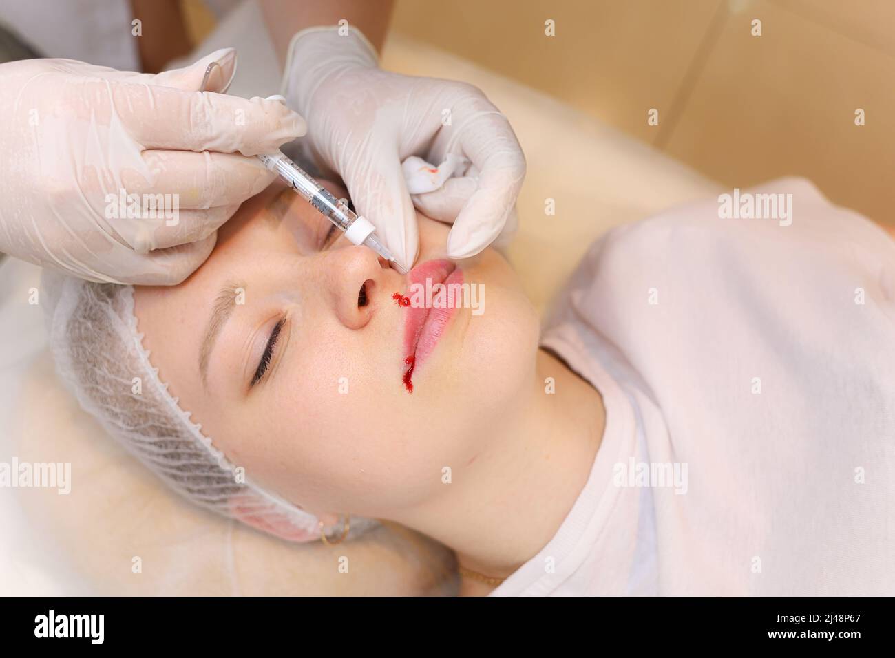 Client Twisting The cosmetologist holds the client's upper lip with two fingers ...