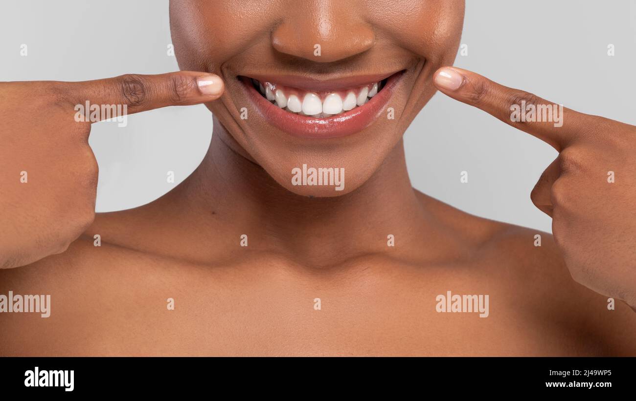 Smiling millennial african american female pointing fingers at perfect snow white smile Stock Photo