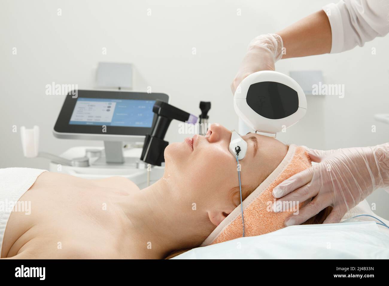 A woman receives laser treatment of the face in a cosmetology clinic, a concept of skin rejuvenation is being developed. laser peeling Stock Photo