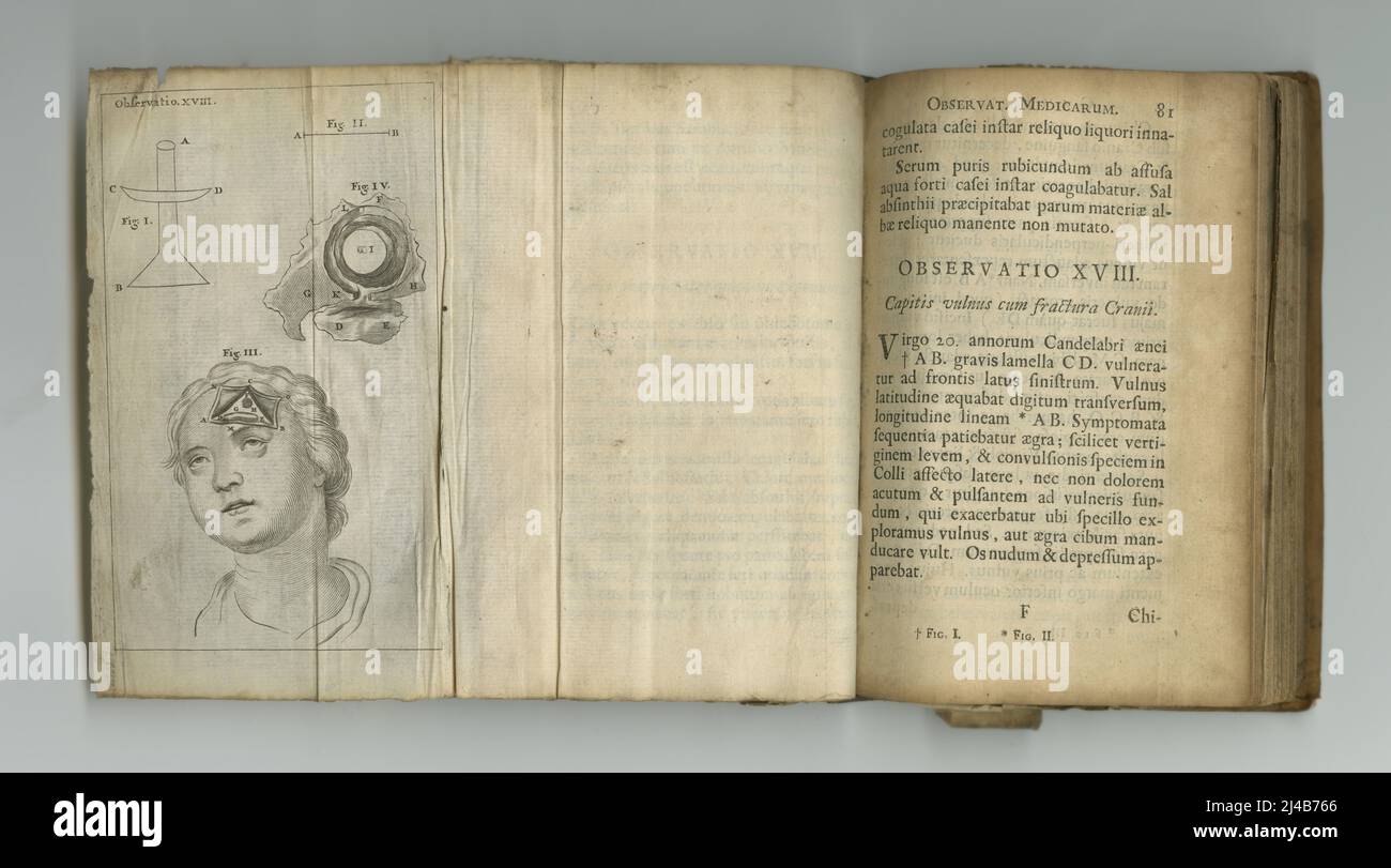 Aged medical knowledge. An old medical book with its pages on display