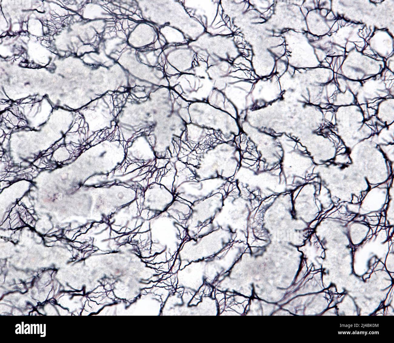 Reticular fibres in human liver, light micrograph Stock Photo - Alamy