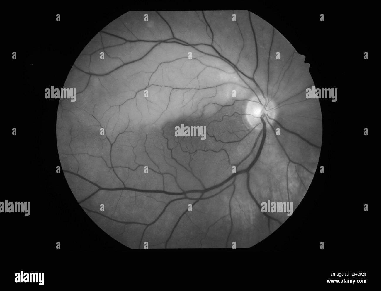 Fundus Black and White Stock Photos & Images - Page 2 - Alamy