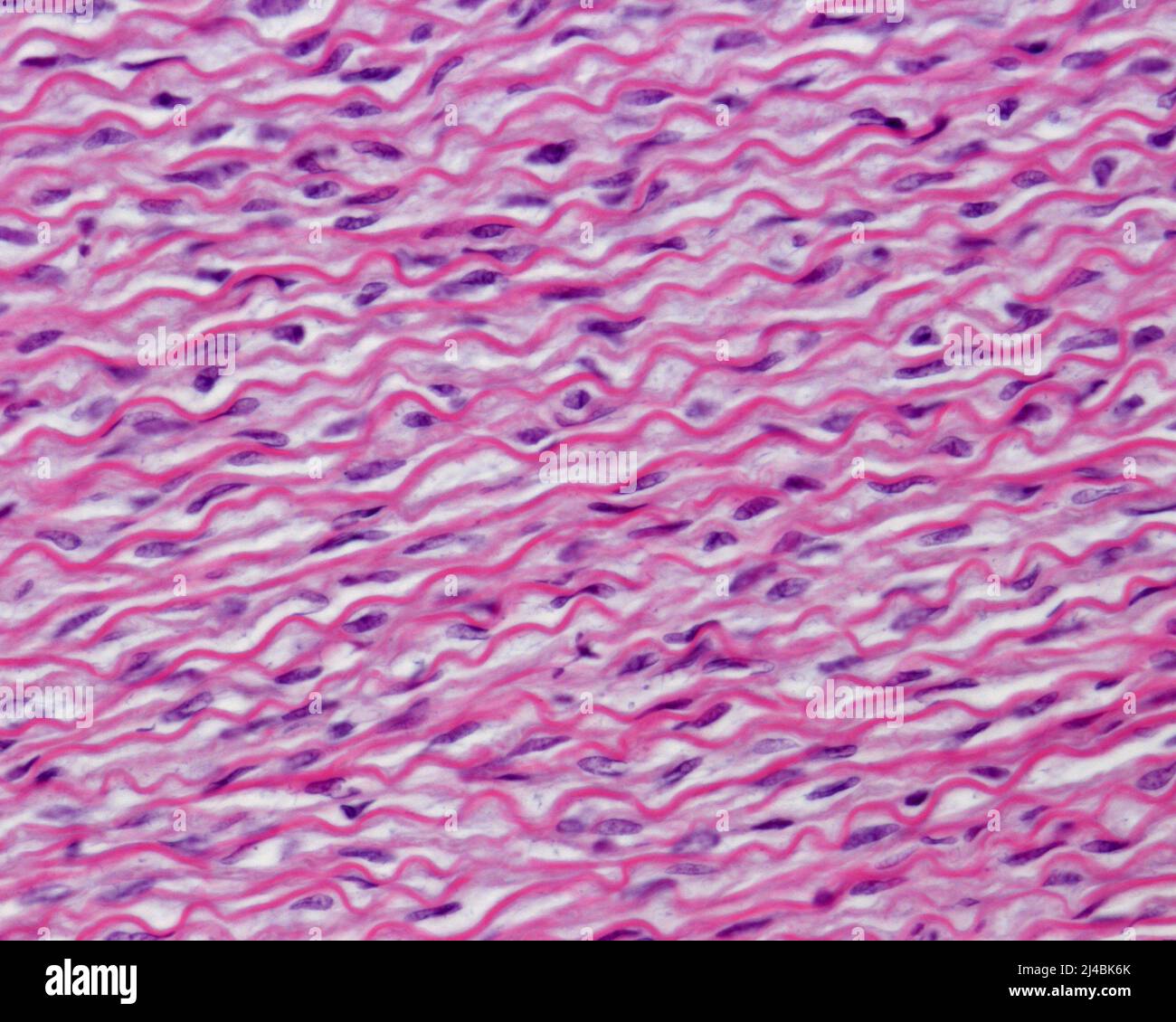 Elastic lamellae in human aorta, light micrograph Stock Photo Alamy