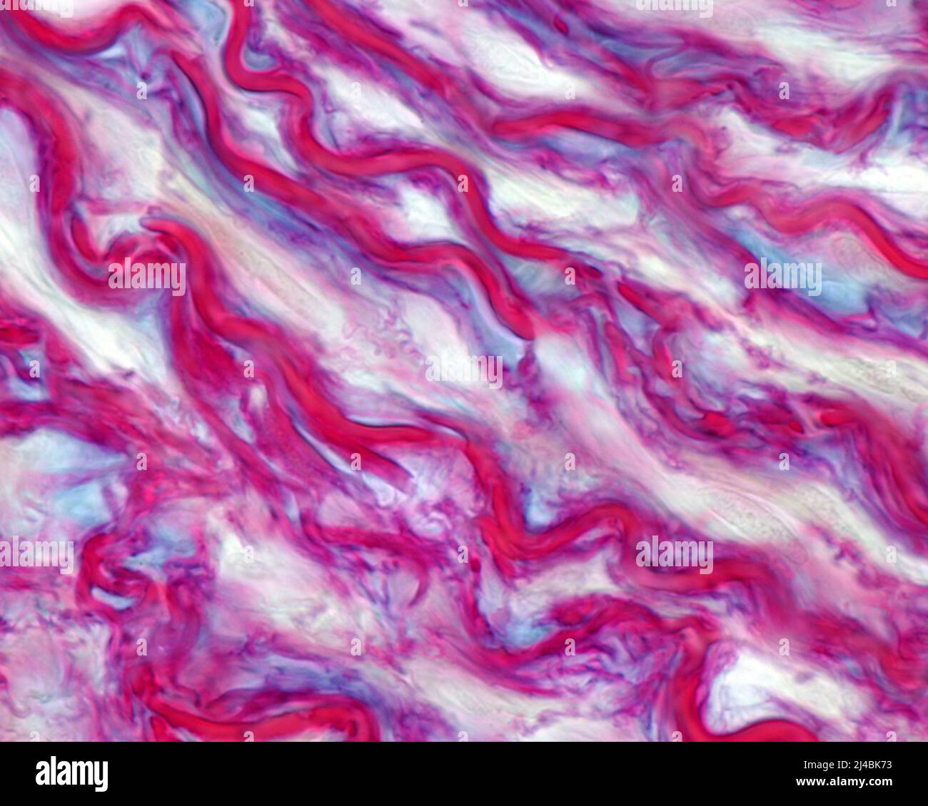 Elastic lamellae in aorta, light micrograph Stock Photo Alamy