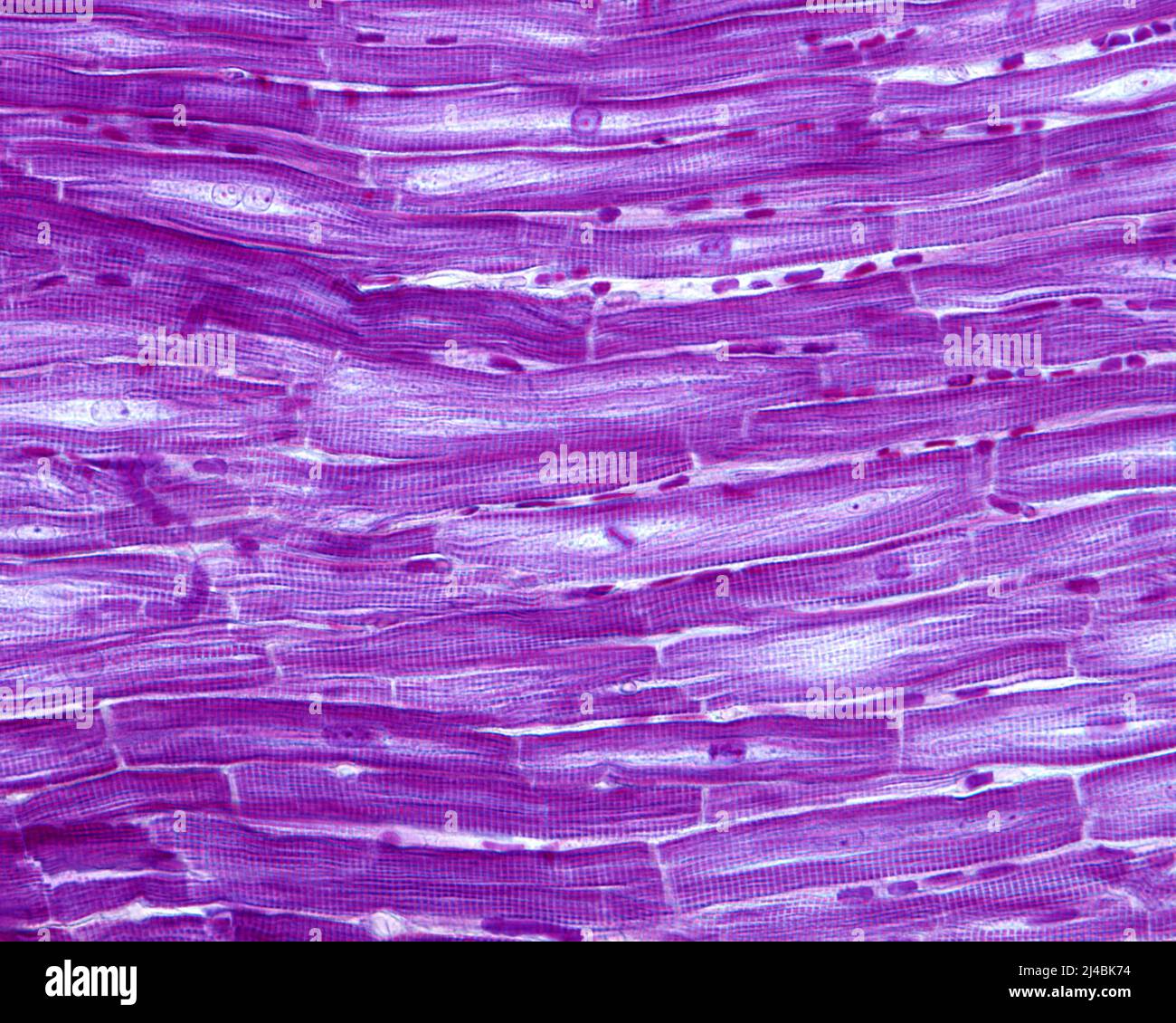 Intercalated discs in heart myocardium, light micrograph Stock Photo