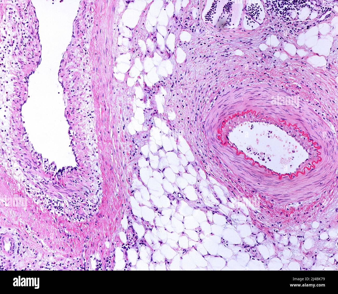 Muscular artery and vein, light micrograph Stock Photo Alamy