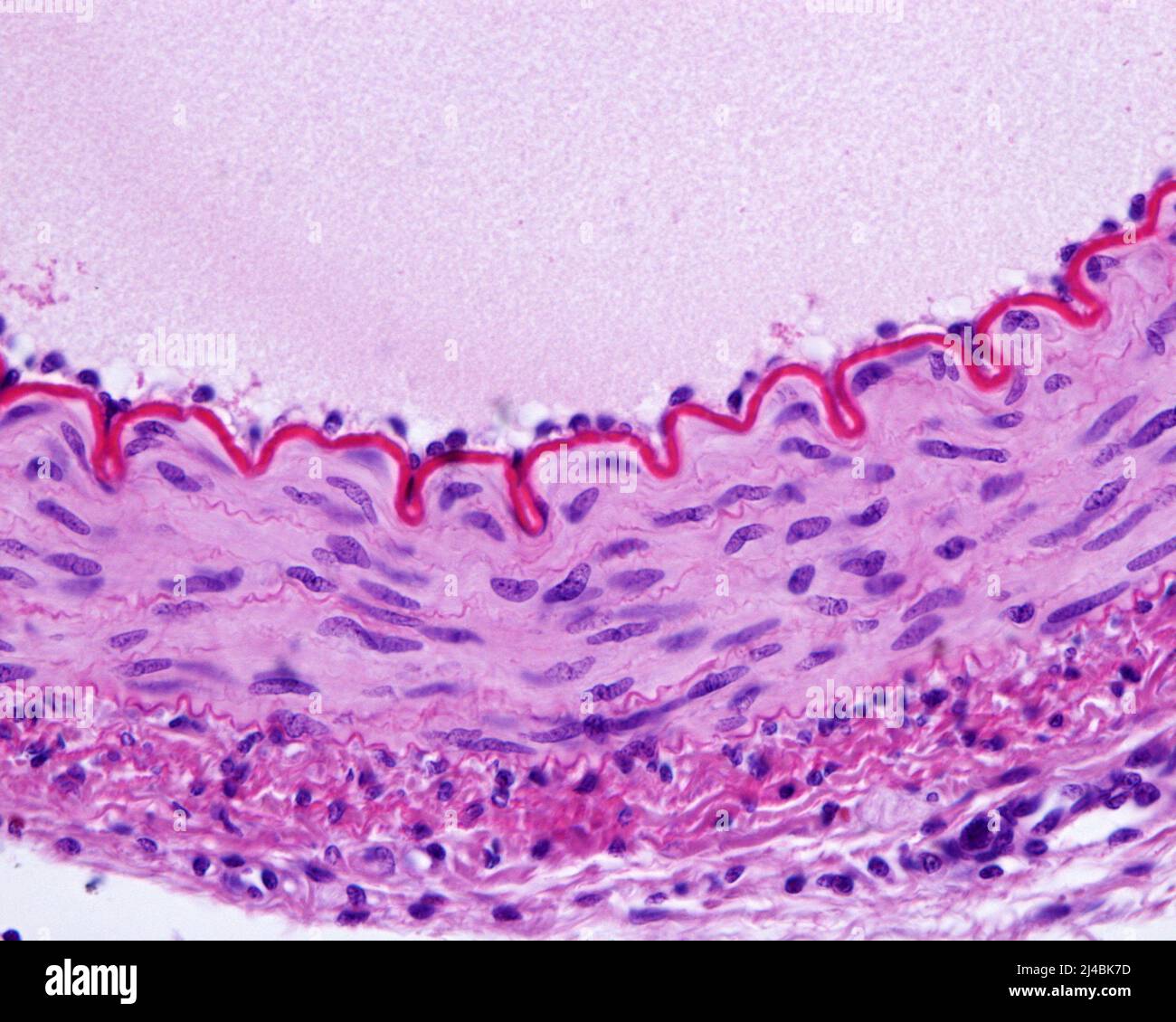 Muscular artery wall, light micrograph Stock Photo - Alamy