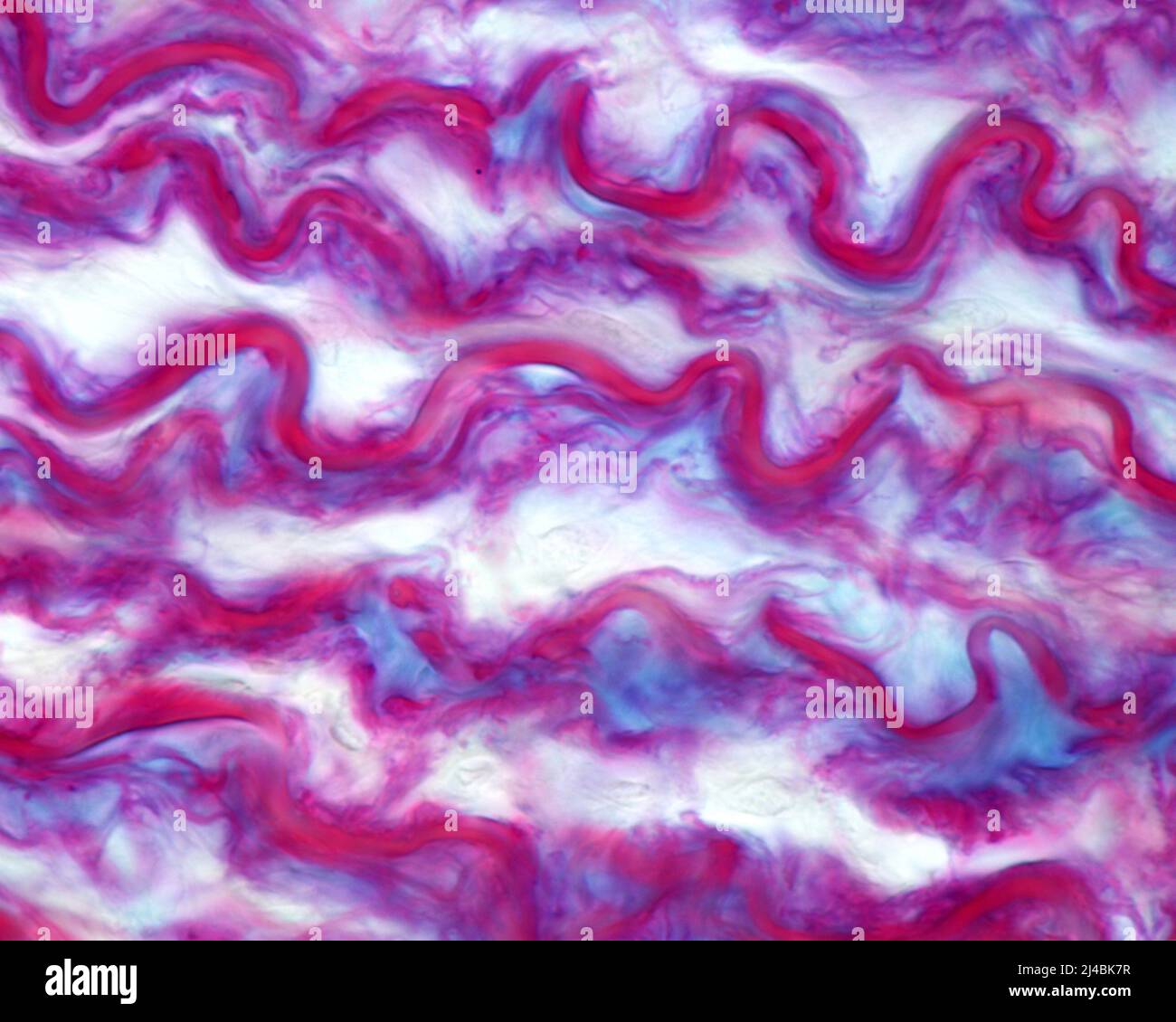 Elastic lamellae in aorta, light micrograph Stock Photo Alamy