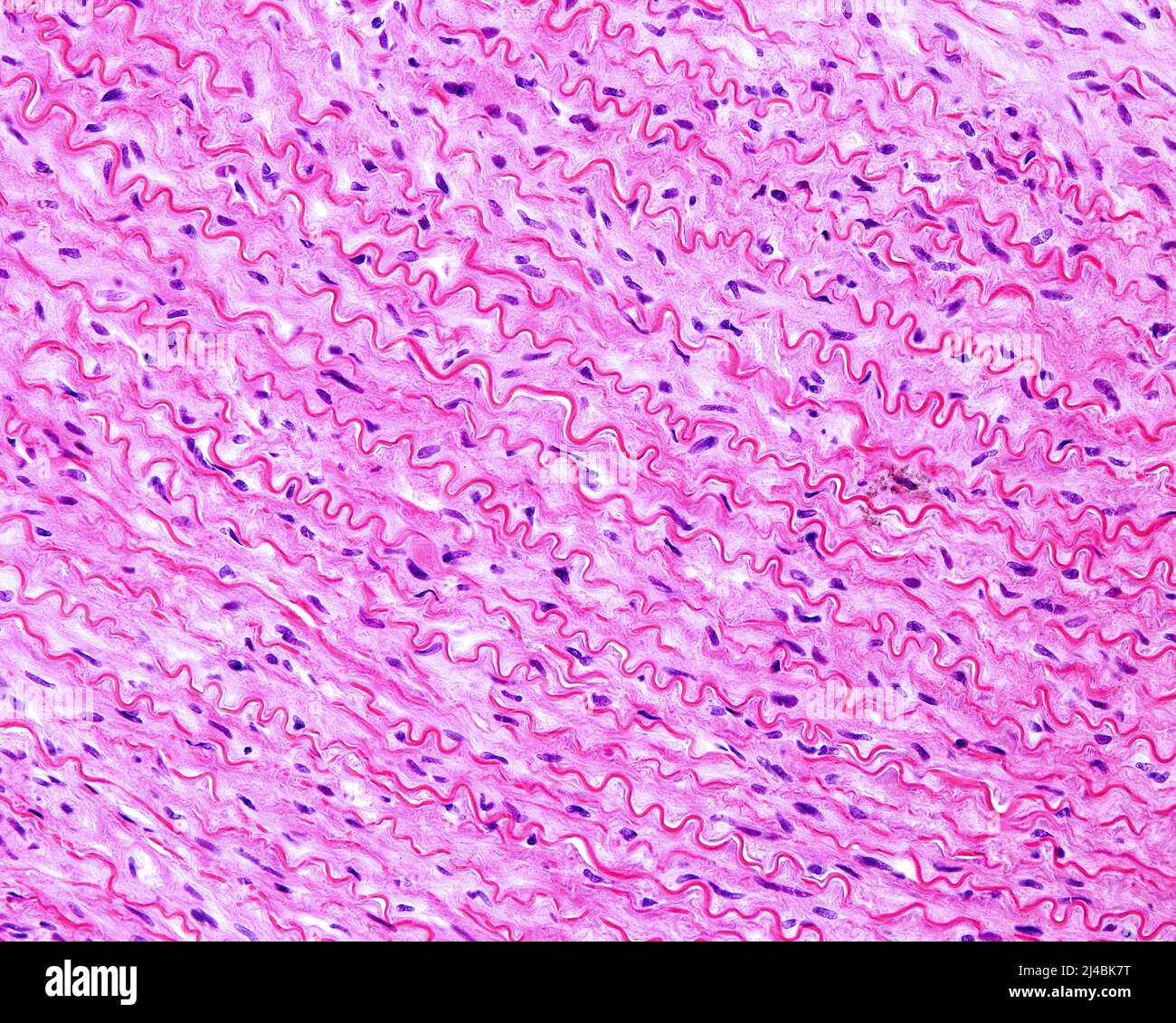 Elastic lamellae in human aorta, light micrograph Stock Photo Alamy