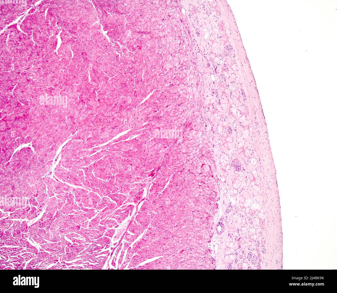 Purkinje fibres in the heart, light micrograph Stock Photo Alamy