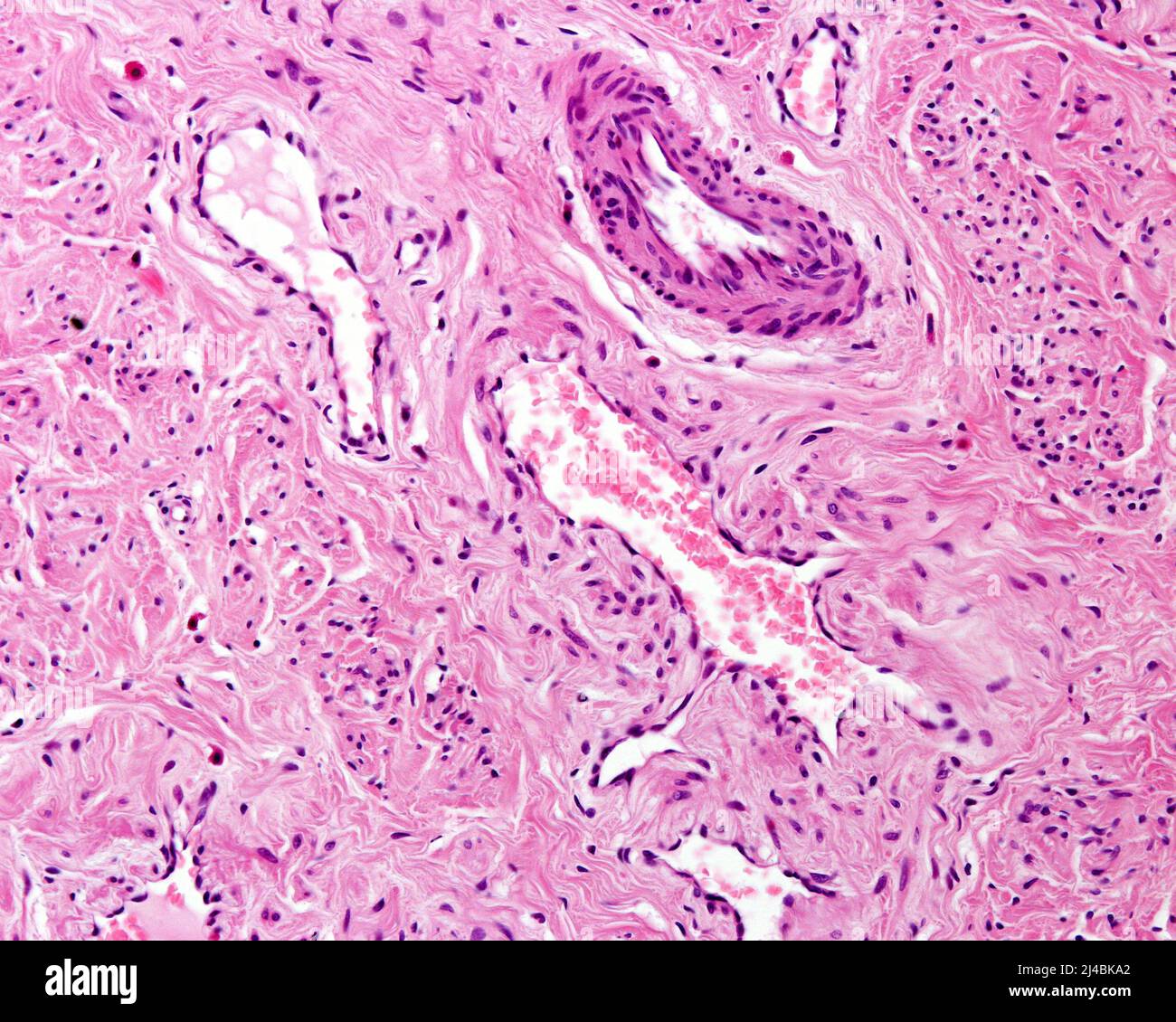 Blood vessels in connective tissue, light micrograph Stock Photo - Alamy