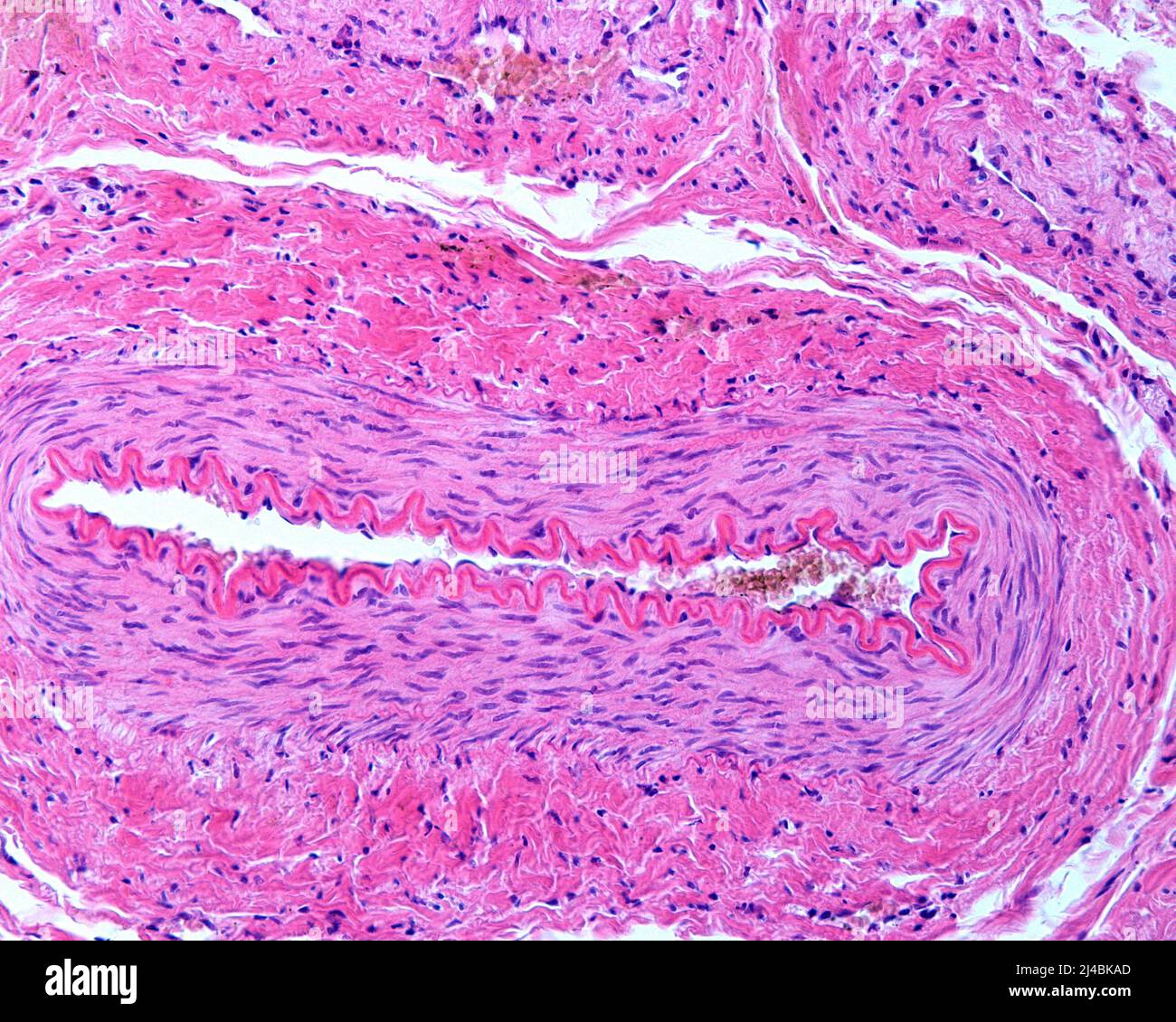 Muscular Artery Wall Light Micrograph Stock Photo Alamy muscular-artery-wall-light-micrograph-stock-photo-alamy