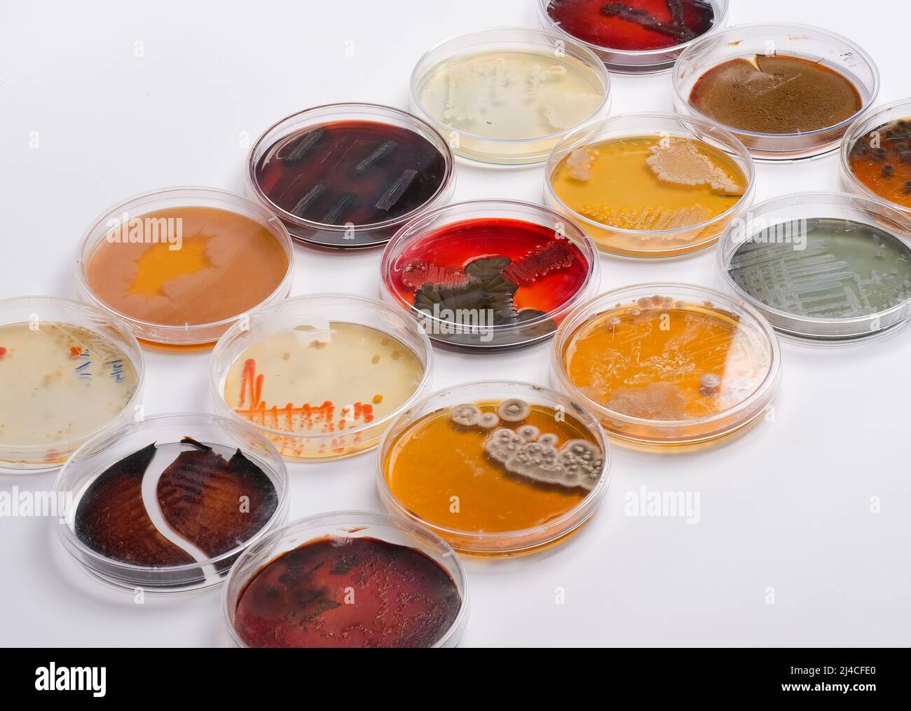 COLLECTION OF PETRI DISHES CONTAIN GROWTH OFBACTERIAL AND FUNGAL CELLS
