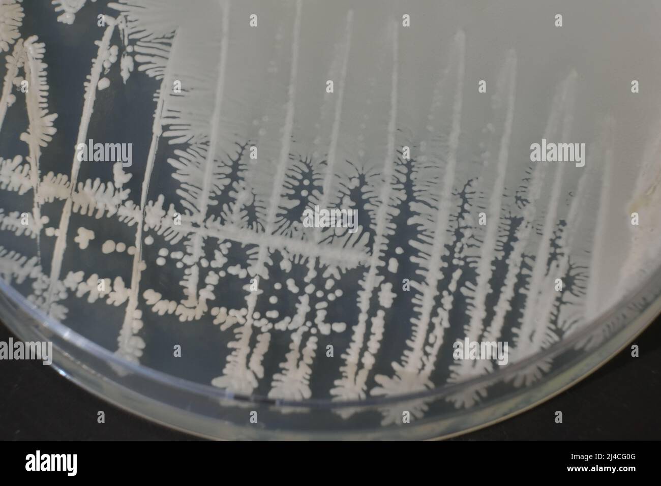 CLOSEUP PHOTO OF BACTERIA AND FUNGI GRWOTH ON AGAR MEDIA IN A PLASTIC ...