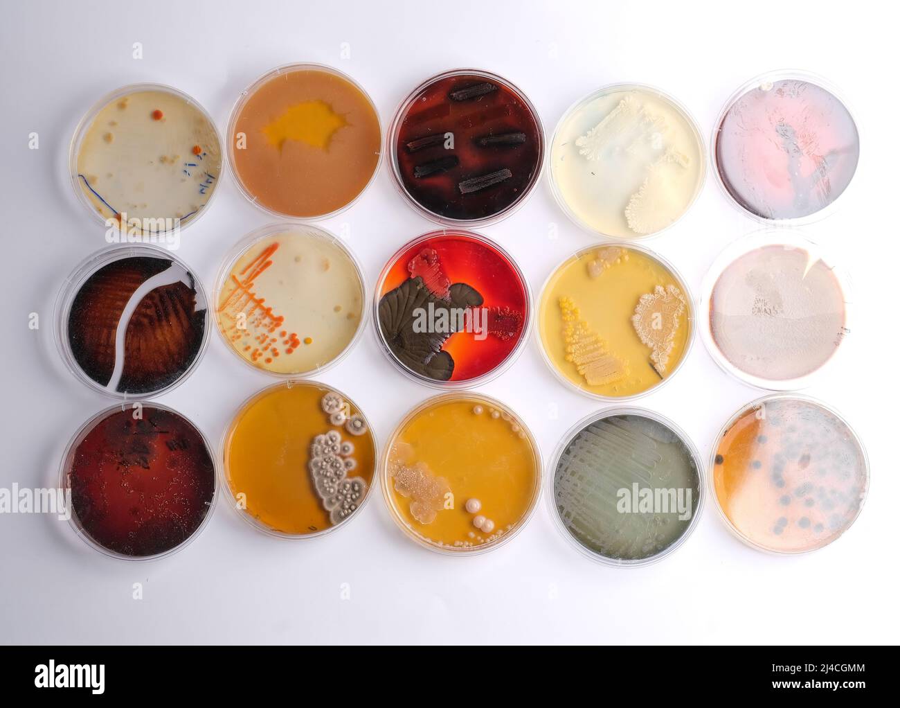 COLLECTION OF PETRI DISHES CONTAIN GROWTH OFBACTERIAL AND FUNGAL CELLS