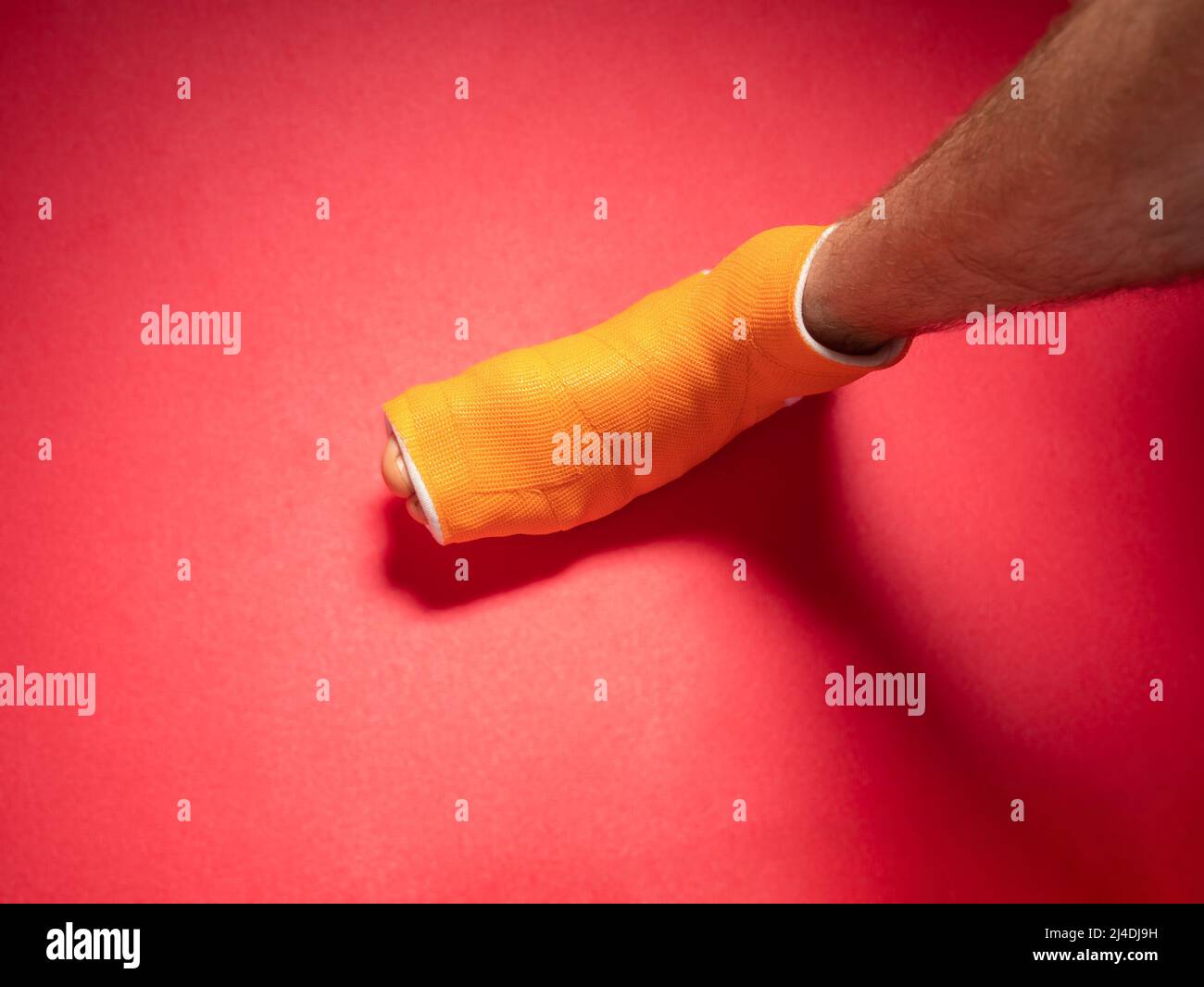 Foot with broken toe bone in orange fiberglass cast pink background