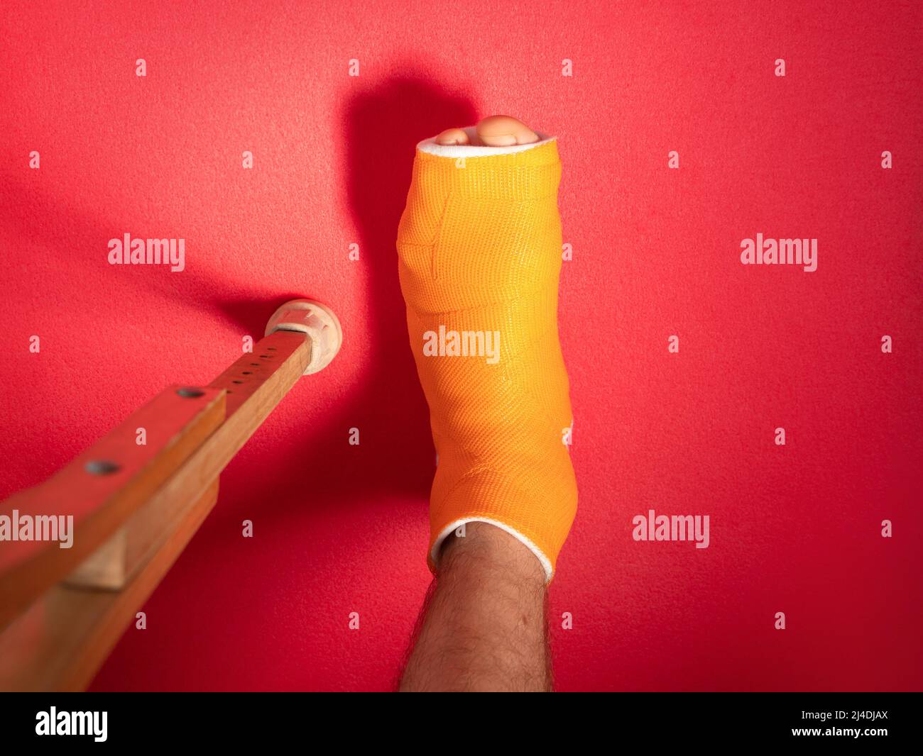 Foot with broken toe bone in orange fiberglass cast pink background