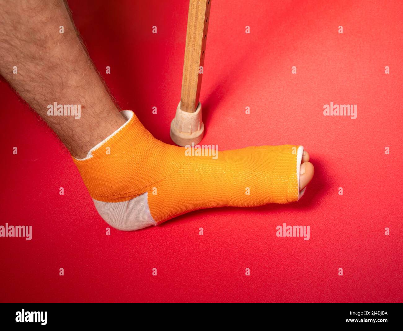 Foot with broken toe bone in orange fiberglass cast pink background