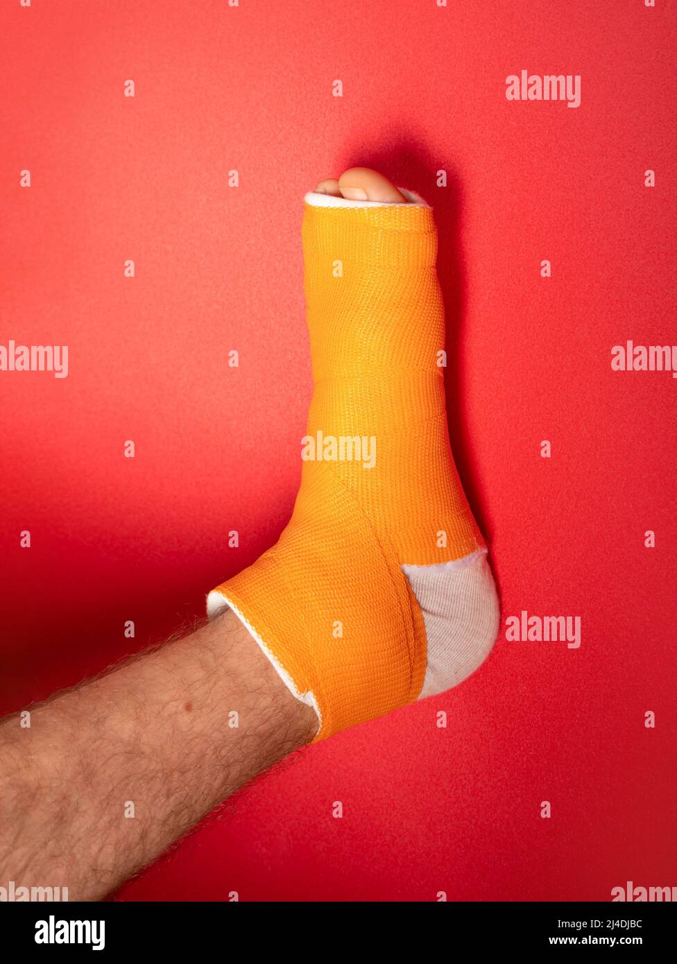Foot with broken toe bone in orange fiberglass cast pink background ...