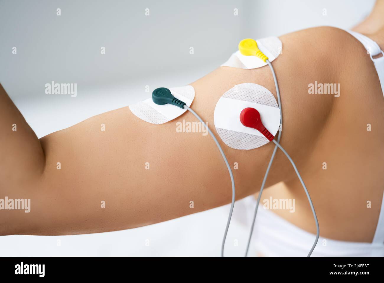 Electrode Arm Stimulation And Training. Pain Therapy And Massage Stock Photo