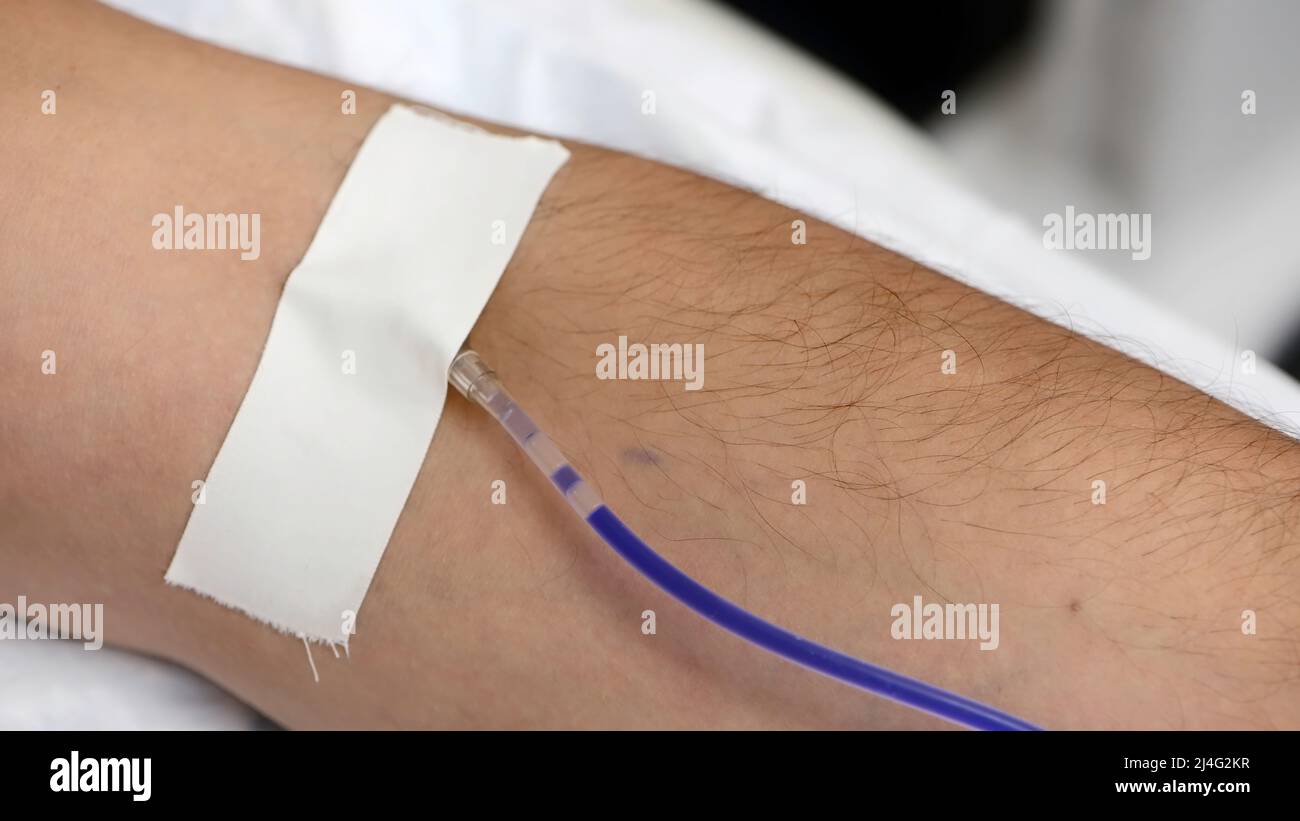 Plasmapheresis process, cleaning the patient's blood through the device