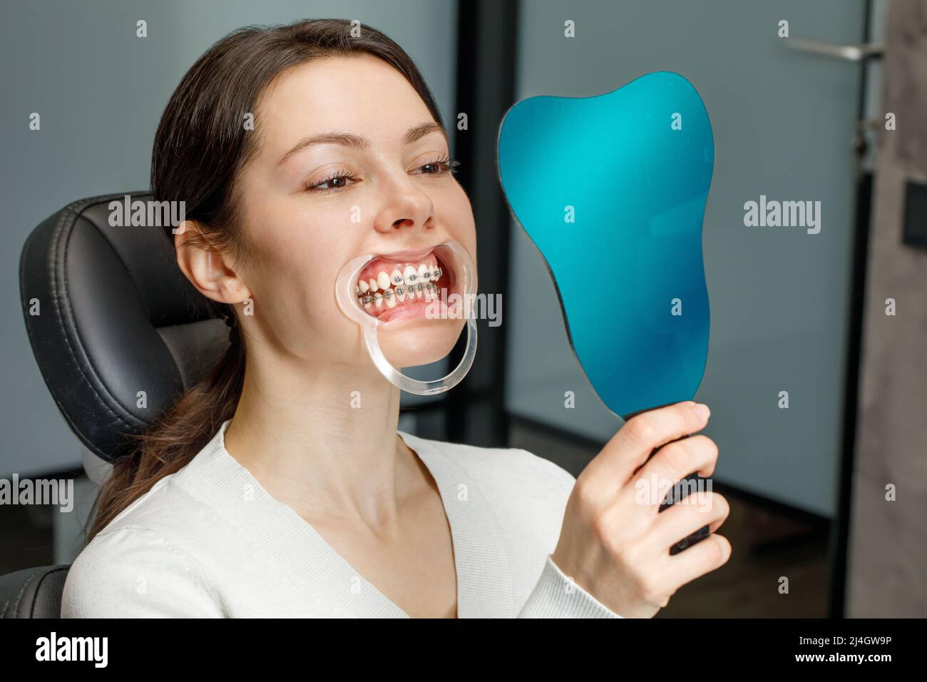 Teeth braces smile smiling hi-res stock photography and images - Alamy