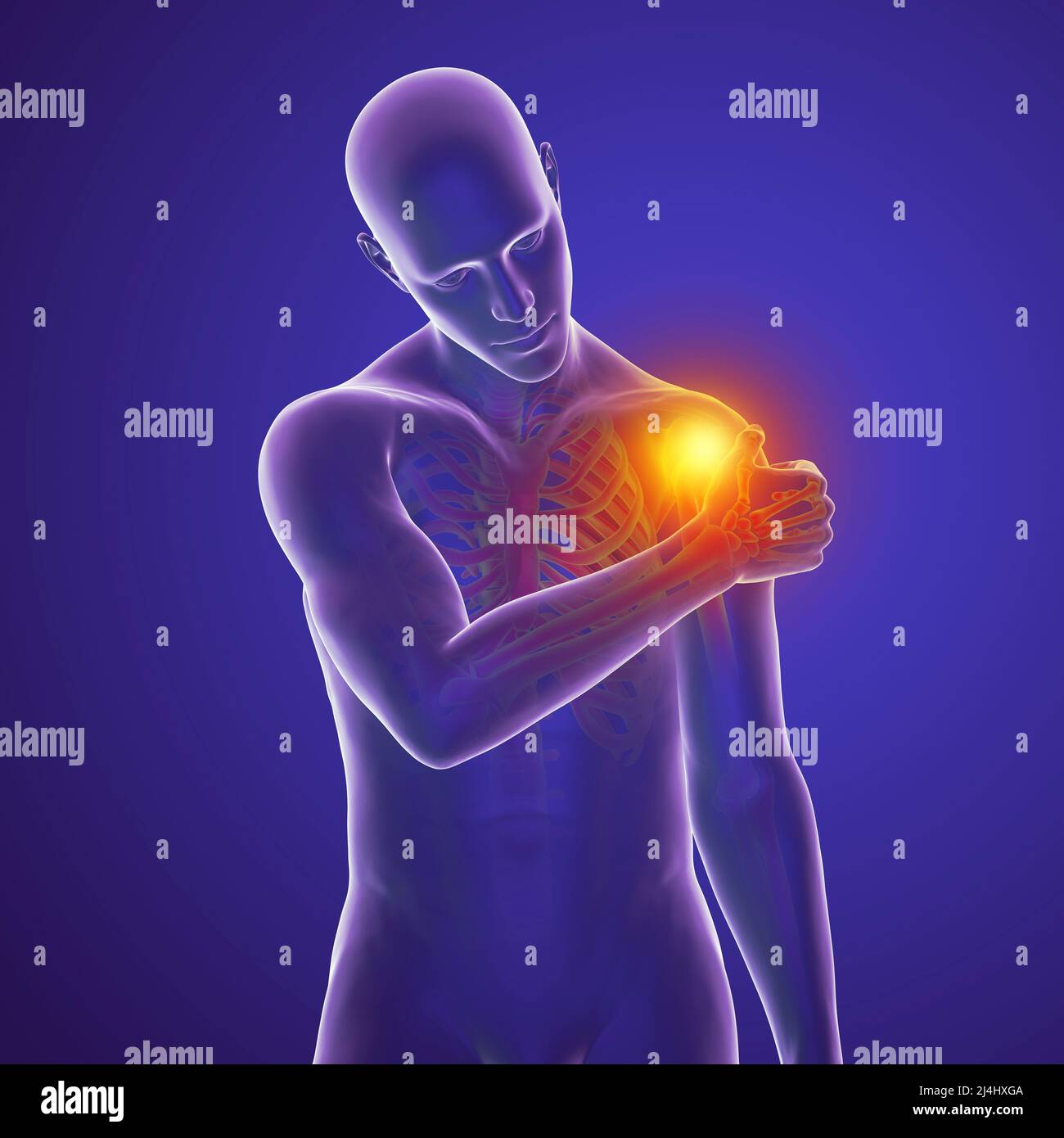 Painful shoulder, illustration Stock Photo